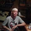 tsnmayo